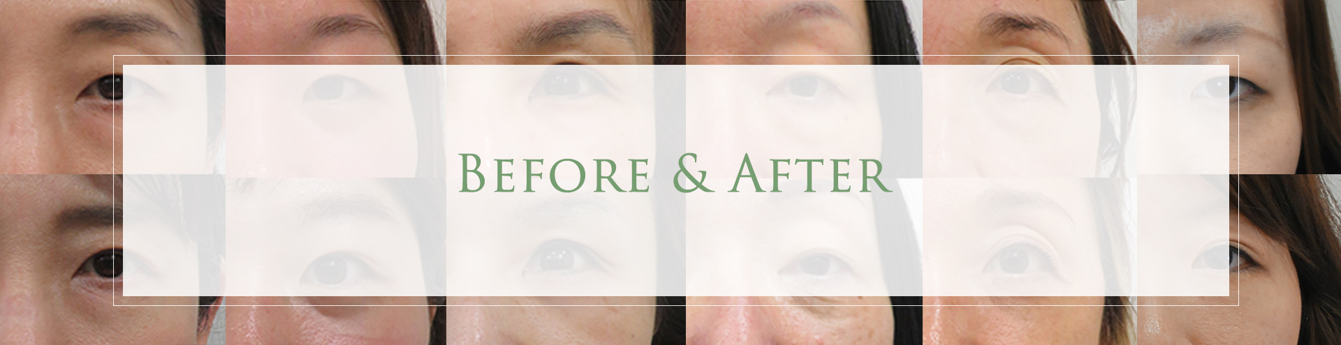 ビフォーアフター集